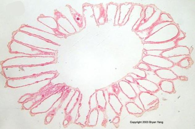 <p>what is this and is this a cross or lateral section</p>