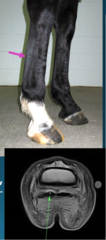<p>What is the etiology for deep digital flexor tendonitis?</p>