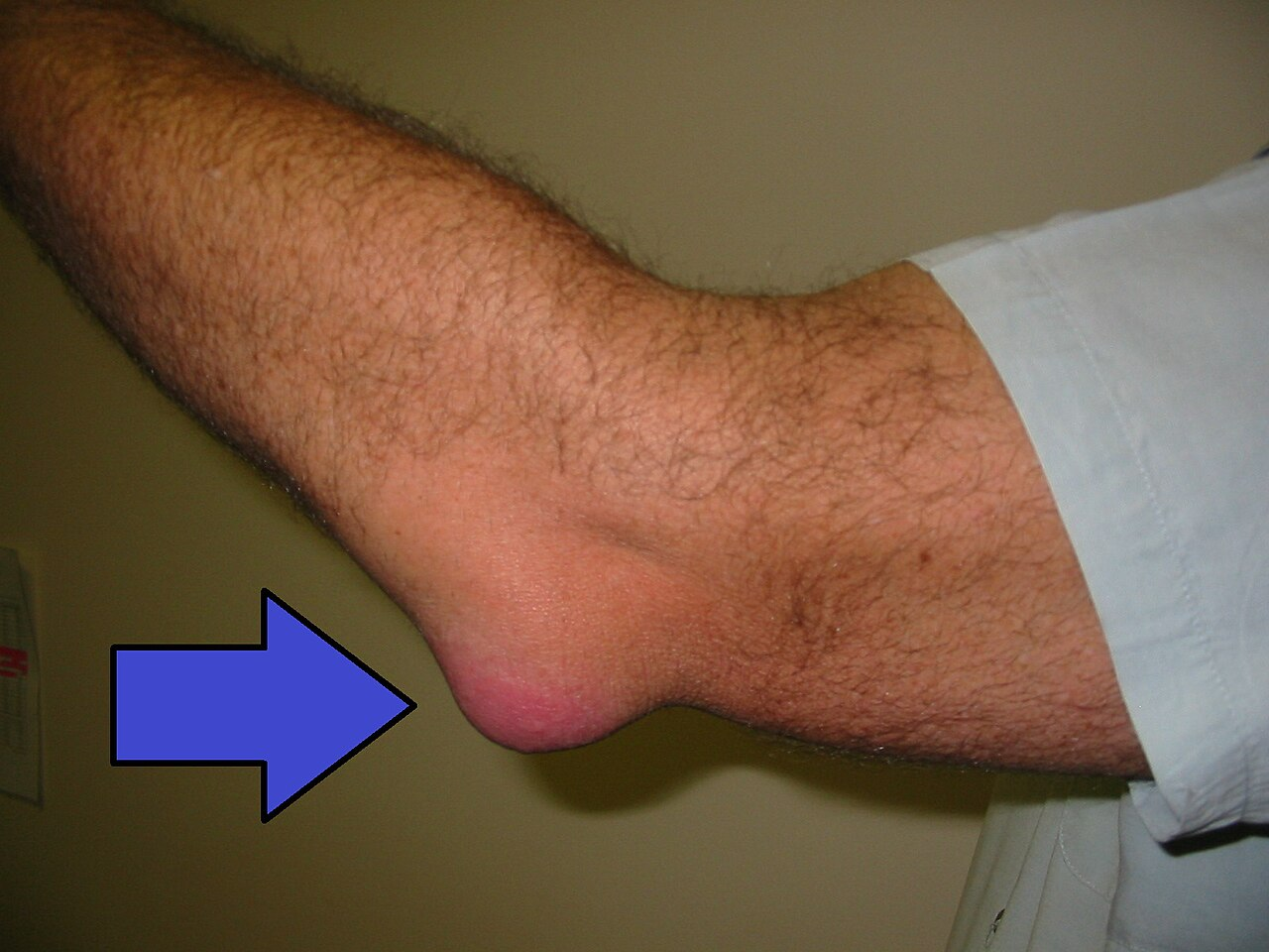 <p>What injury / condition? </p>