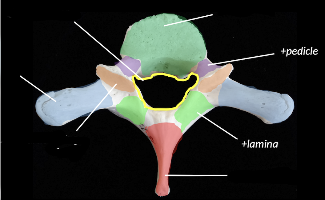 <p>what bone is the highlighted orange area ? </p>