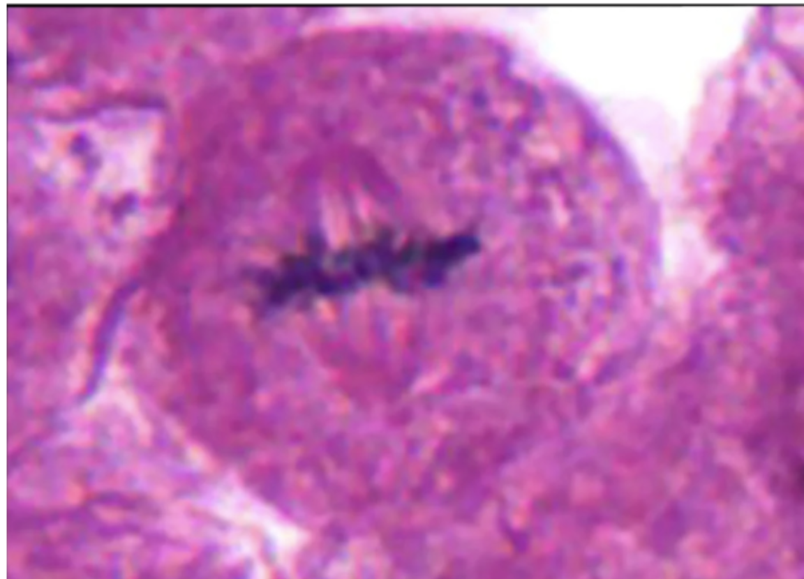 <p><span style="background-color: transparent;">metaphase</span></p>