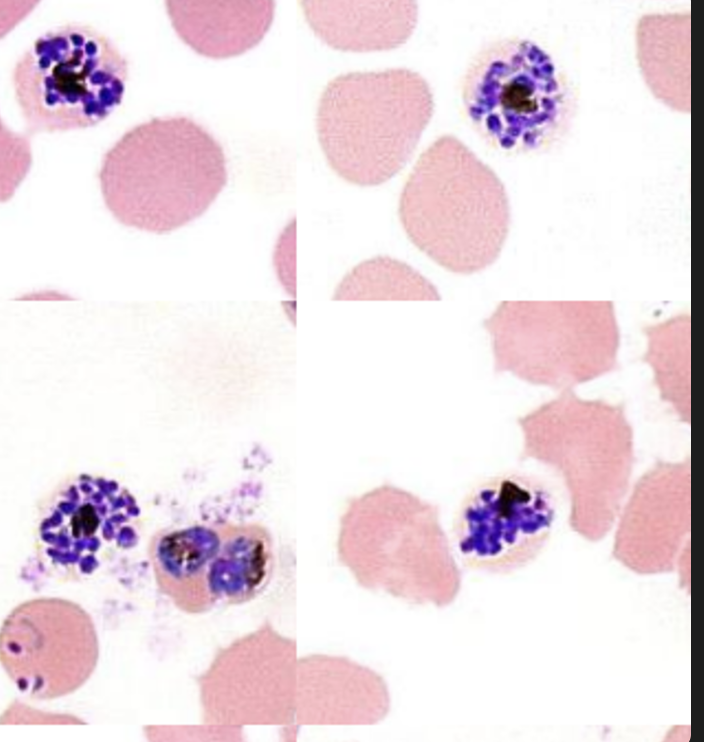 <p>Name: Plasmodium falciparum</p><p class="p1">Stage: schizont</p>
