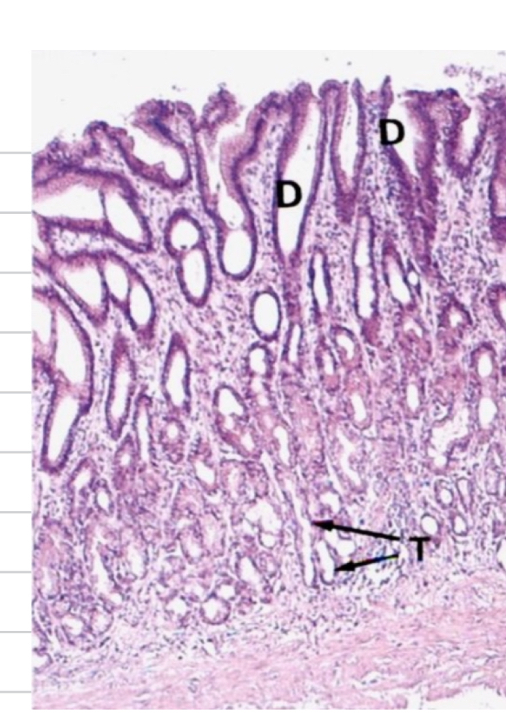 <p>Are simple branched tubular </p><p>Secrete mucous via merocrine secretion to protect form hcl and pepsine they open int</p><p>OPEN INTO gastric pits from tubular secretory portion </p><p>GASTRIC GLANDS CONTAIN ALSO: parietal cells that are zymogenic meaningare  hat they secrete inactive enzyme precurosor ad pepsinogen and lipase </p><p>And enteroendorcirne cells for hormons related to digestion </p>
