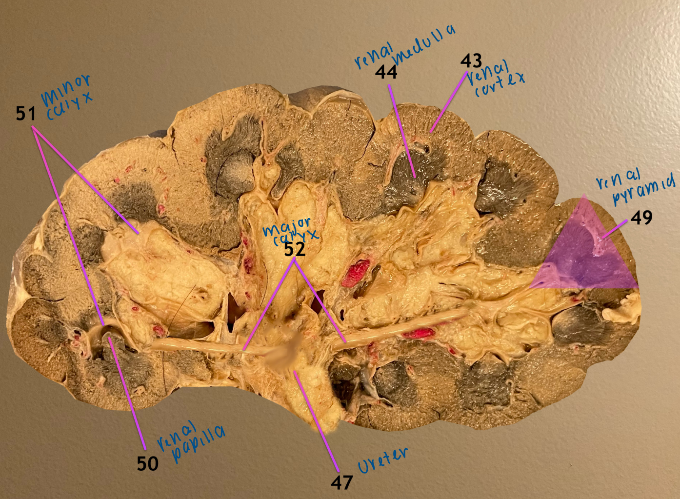 <ol start="43"><li><p>renal cortex</p></li><li><p>renal medulla</p></li></ol><p>.</p><ol start="47"><li><p>ureter</p></li></ol><ol start="49"><li><p>renal pyramid</p></li><li><p>renal papilla</p></li><li><p>minor calyx</p></li><li><p>major calyx / principal branch of the ureter</p></li></ol><p></p>