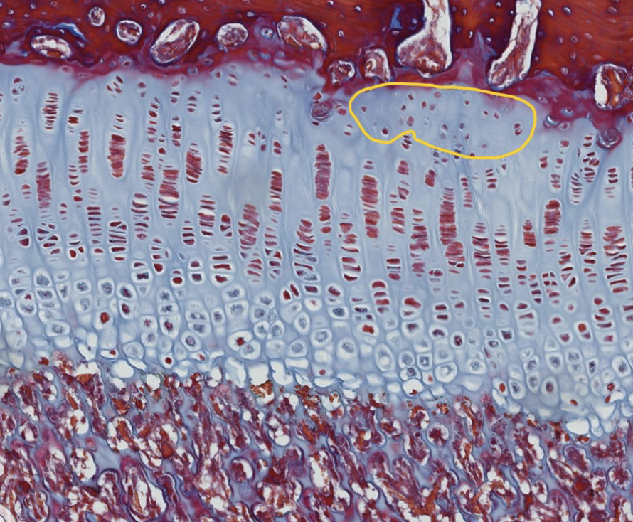 <p>Layers of the physis: which specific zone is encircled?</p>