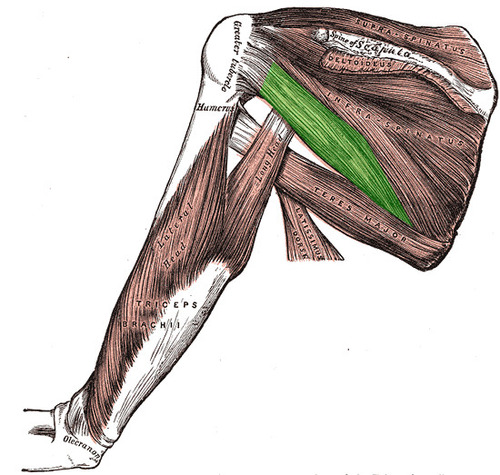 term image