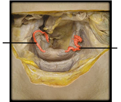 <p>what structure is highlighted?</p>