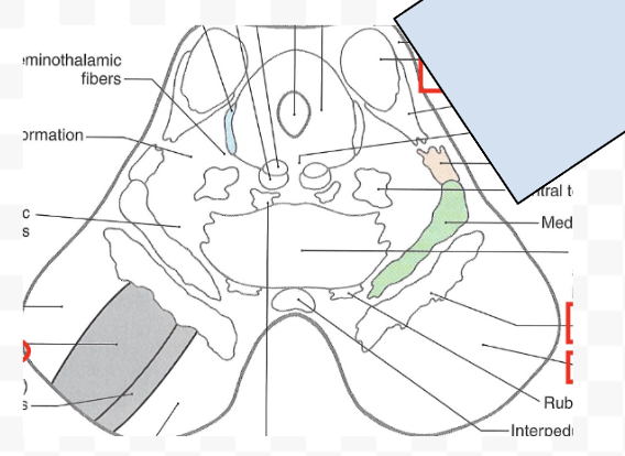 <p>label caudal midbrain with: cerebral aqueduct, inferior colliculus (pericentral, external, central nucleus), corticospinal fibers, substantia nigra, crus cerebri</p>