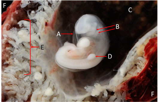 <p>Label A, B, C, D, E and F</p>