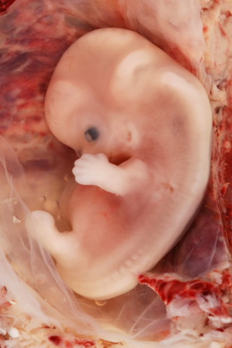 <p>An organism in the earliest stage of development</p>