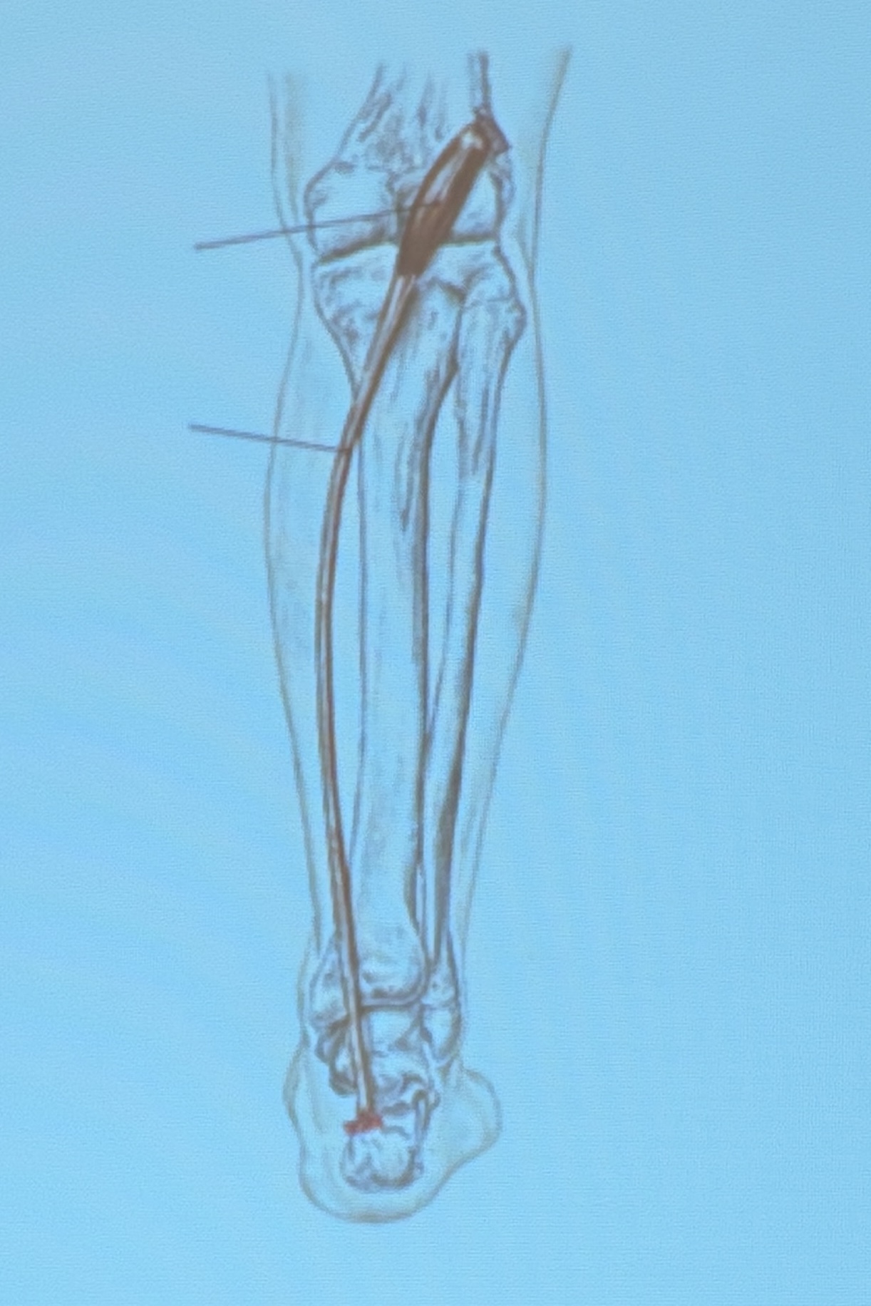 <p>Muscle name?</p>