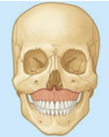 <p>What type of fracture?</p>