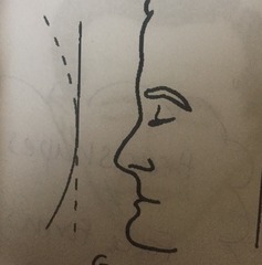 <p>forehead vertical, chin protrudes</p>