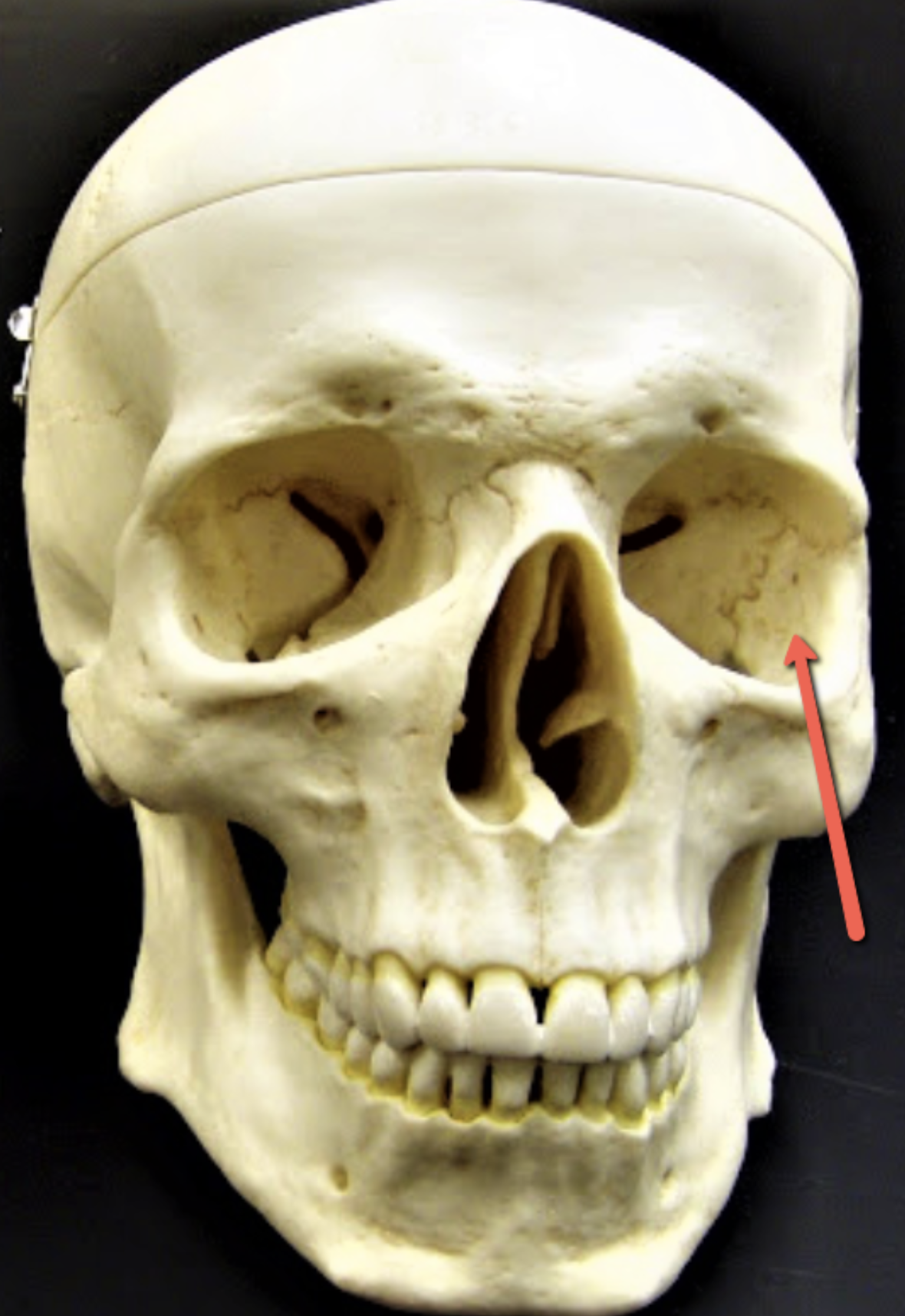 <p><span><strong>Identify the bone marking indicated by the pointer.</strong></span></p>