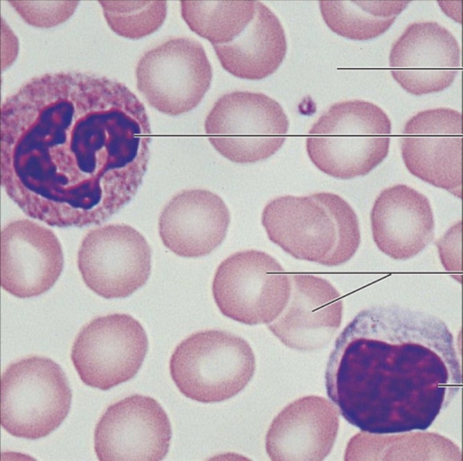 <p>what is the name of this tissue?</p>