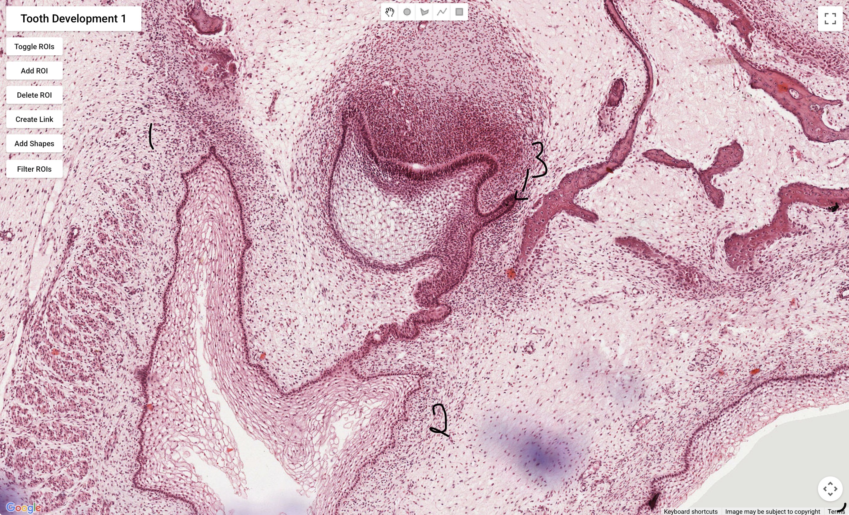 term image