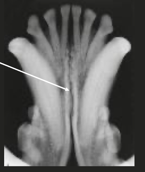 <p>Is this a fracture?</p>
