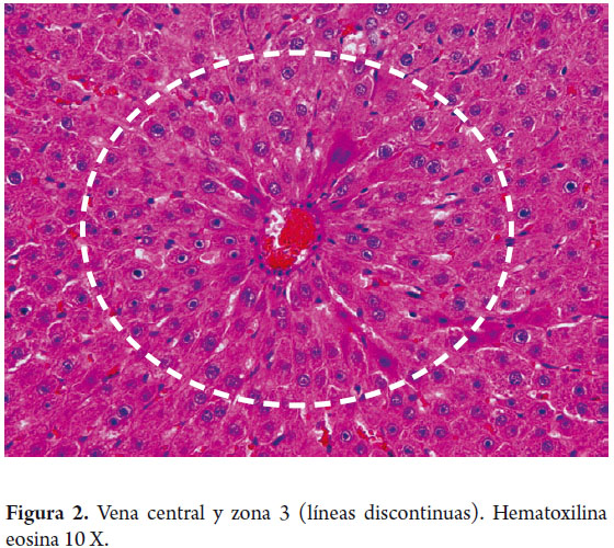 <p>Existen áreas de parénquima hepático que reciben <mark data-color="#89b8eb" style="background-color: rgb(137, 184, 235); color: inherit;">menos sangre oxigenada,</mark> ¿cuál es?</p>