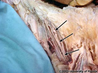 <p>what structure is being indicated to in the image? (context: image is taken of spermatic cord)</p>
