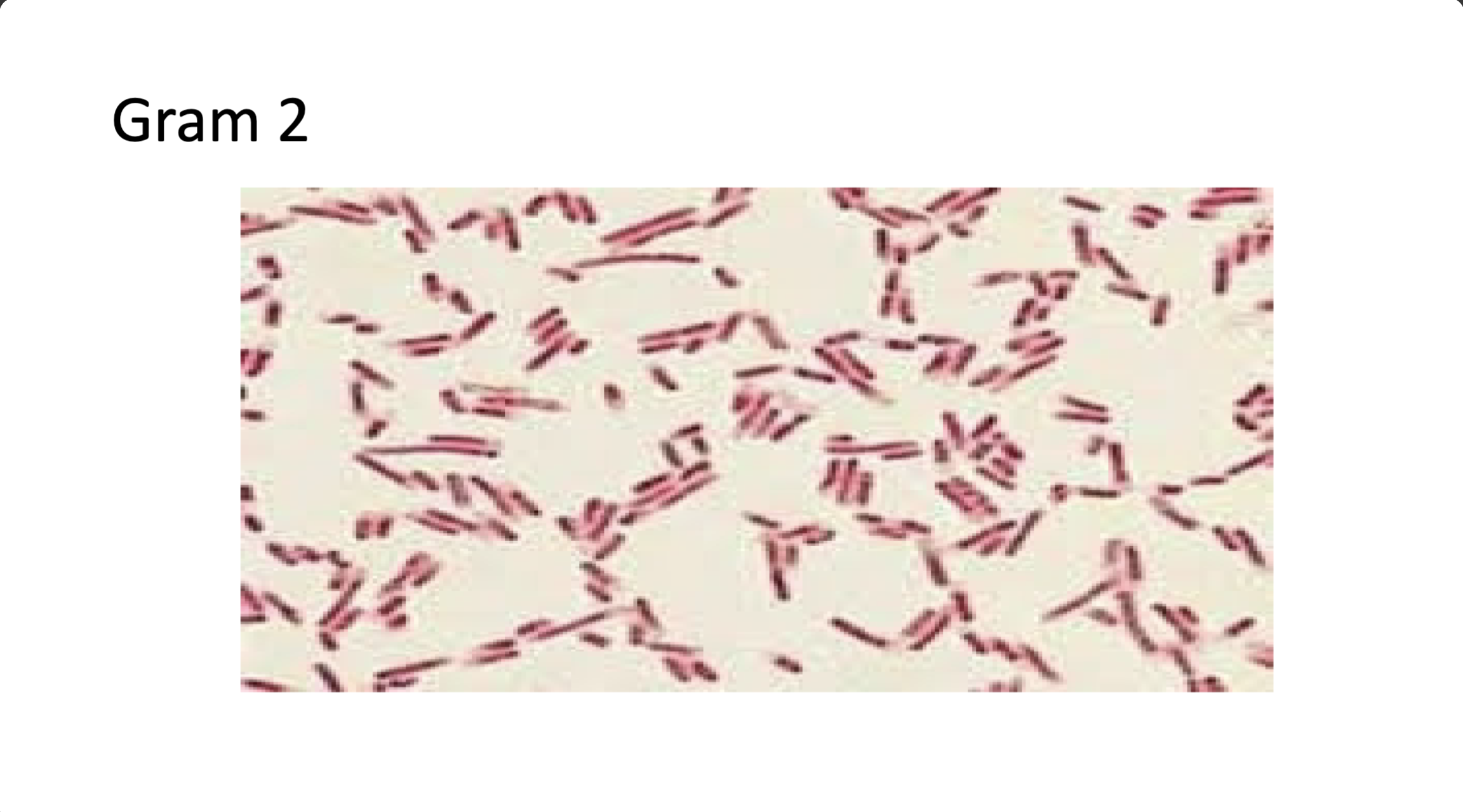 <p>positive/negative and morphology</p>