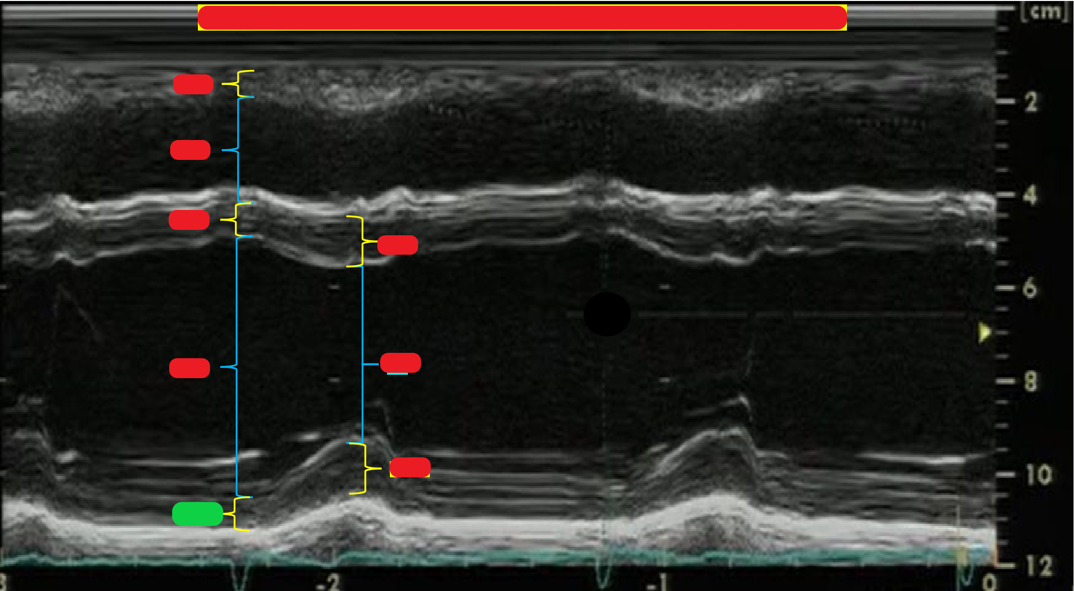 <p>What is highlighted in green?</p>