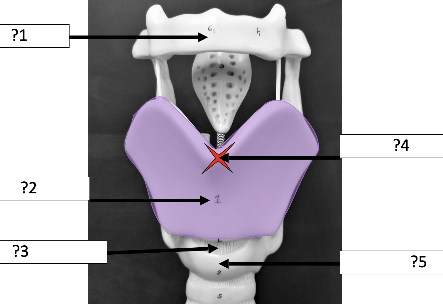 <p>4 Name the specific point? </p>