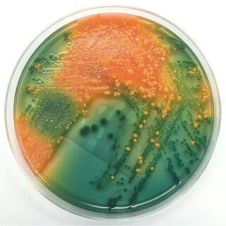 <ul><li><p>Selective for GNR (higher concentration of bile salts than MAC)</p><ul><li><p>Still inhibits many normal flora Enterics </p></li></ul></li><li><p>Differentiates: lactose and sucrose fermenters; ferric salt producers (H<sub>2</sub>S - hydrogen sulfide) </p></li></ul><p></p><p>Interpretation</p><ul><li><p>Lactose &amp;/ sucrose fermenter = yellow/orange colonies </p></li><li><p>Lactose &amp;/sucrose non-fermenter = colorless, blue/green</p></li><li><p>H<sub>2</sub>S production = black precipitate </p></li></ul><p></p>