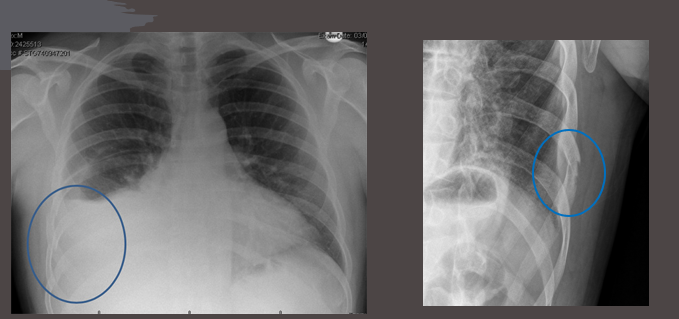 <p>what pathology is this?</p>