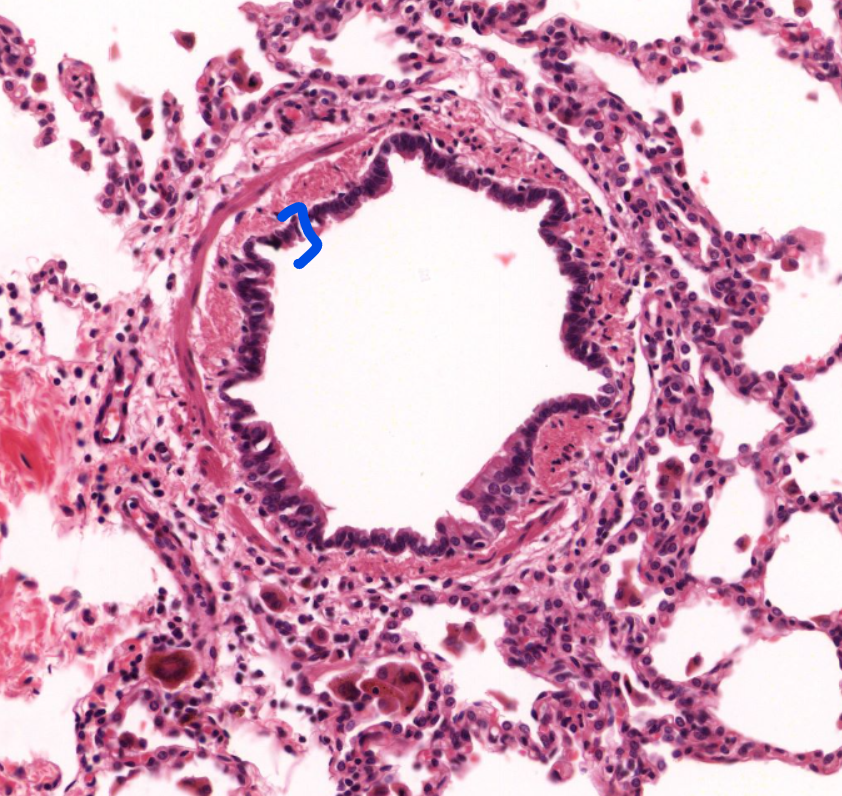 <p>identify the layer </p>