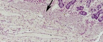 <p>what layer is arrow pointing to (stomach)</p>