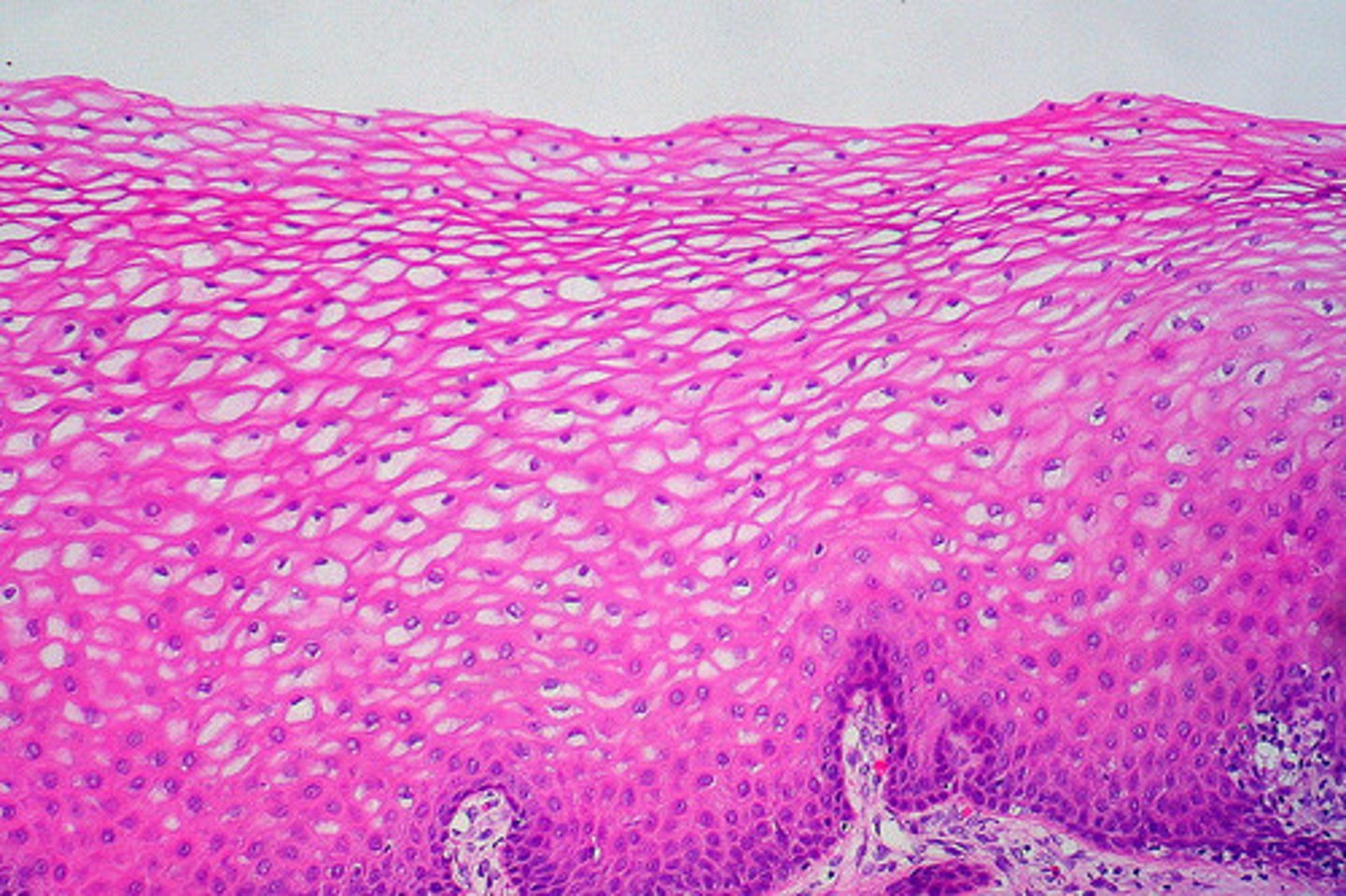 <p>top cells lack nuclei, cells no longer living are filled with keratin that makes it tough/resistant to friction</p><p>(forms on outer layers of skin)</p>