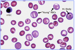<p>1) polychromasia (more "young" red blood cells, i.e. reticulocytes) </p><p>2) presence of nRBCs (nucleated red blood cells)</p><p>3) presence of H-J bodies (only has 1 piece of nuclear material)</p>