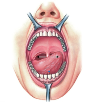 knowt flashcard image