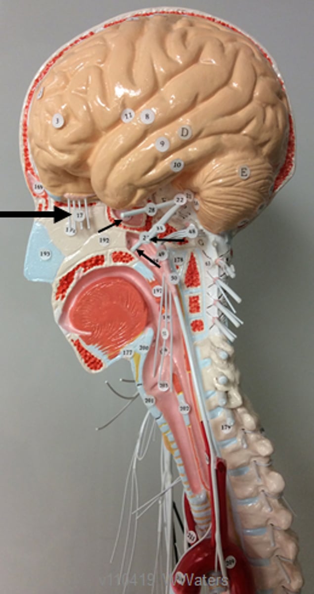 <p>Identify the name and number of this cranial nerve.</p>