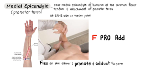 <p>F PRO add</p>