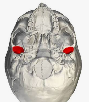 <p>Identify the structure pinned</p>