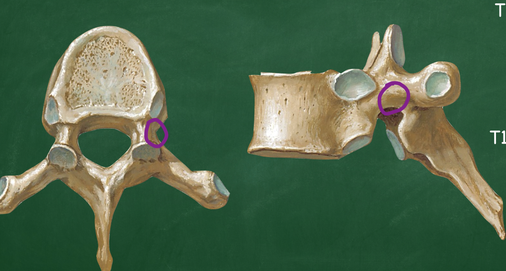 <p>What structure connects the vertebral body to the posterior elements?</p>
