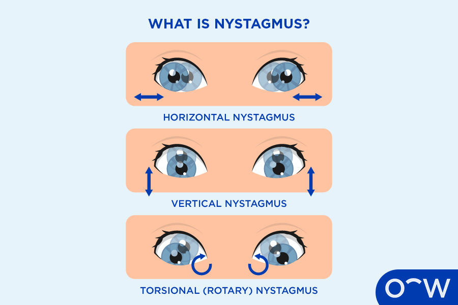 <p>involuntary rapid rhythmic movement of eyeball</p>