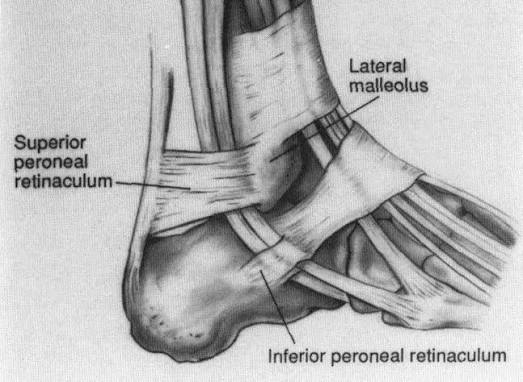<p>lateral aspect of the calcaneus and deep fascia of the leg</p>