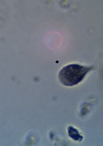 <p>What protist is this?</p>
