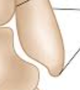 <p>What is this pointing to? What bone is it on?</p>