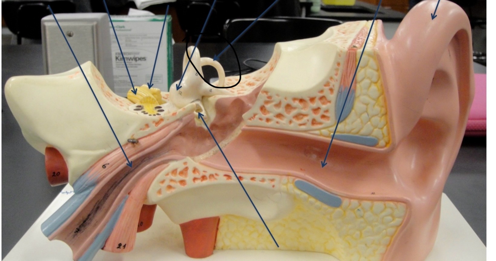 <p>Identify the circled area?</p>