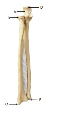 <p>Label B</p>