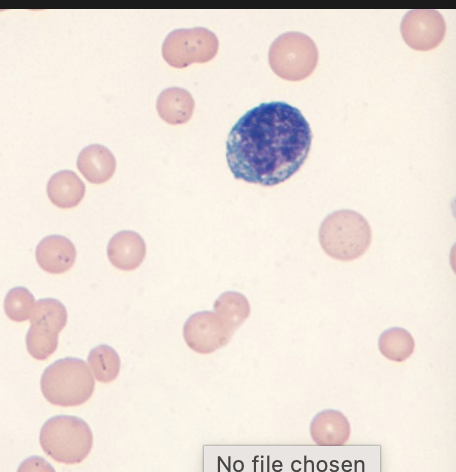 <p>Hemotropic mycoplasma in cats (mycoplasma hemofelis) </p>