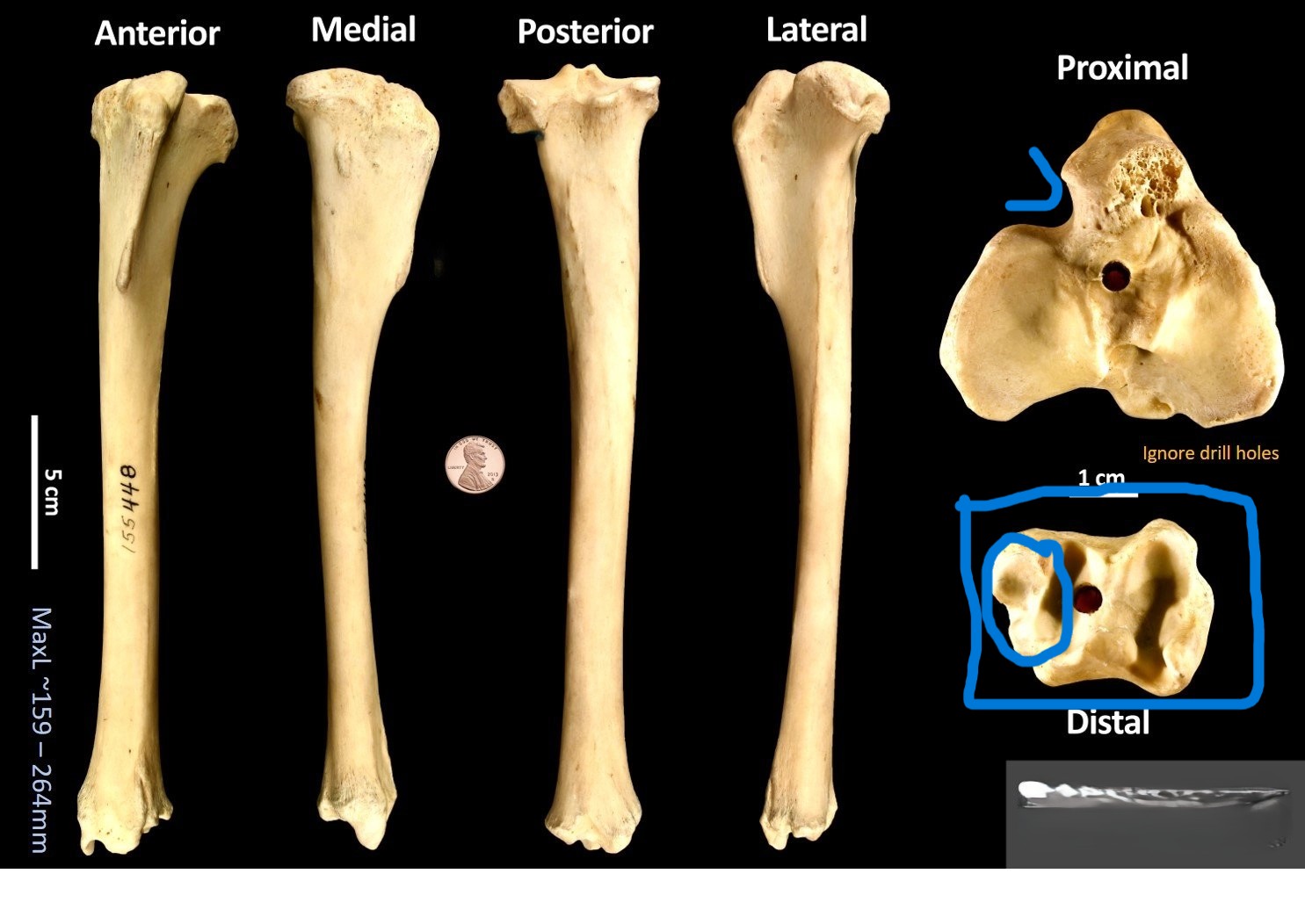 <ul><li><p>Broad U-shaped notch</p></li><li><p>rectangular distal articulation</p></li><li><p>two extra facets on distalarticulation</p></li></ul><p></p><p>sheep tibia </p><p></p>
