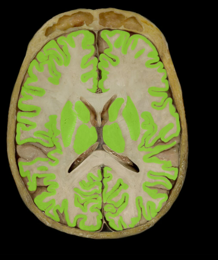 <p><span>Gray matter</span></p>