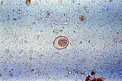 <p>Identify the parasite</p>