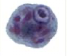 <p>What Amaeba is this?</p>