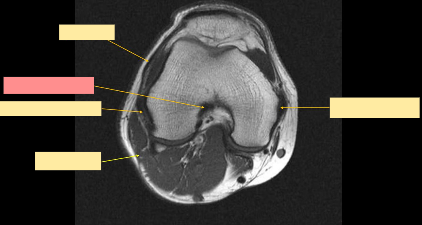 <p>Identify this structure</p>