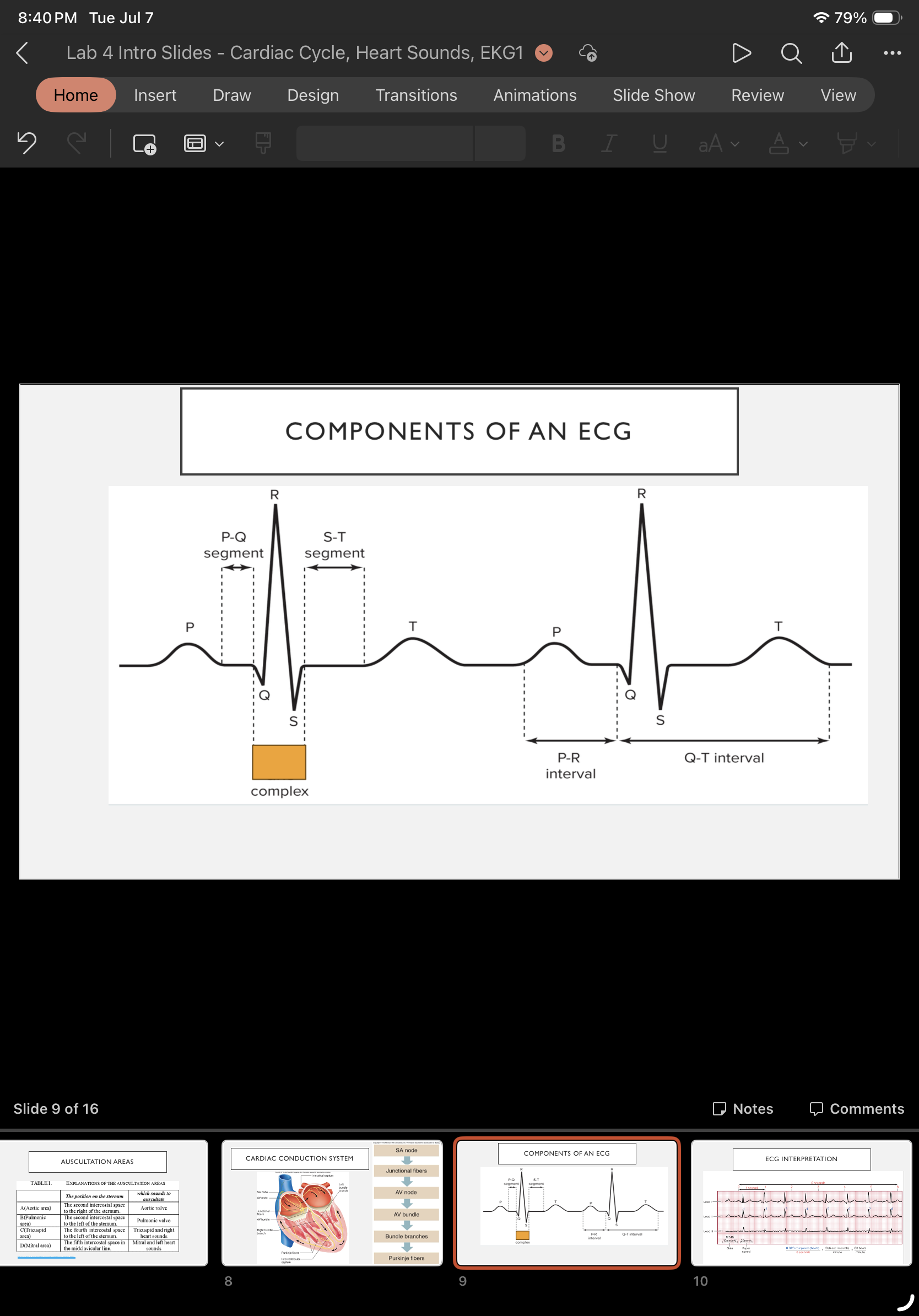 <p>What complex is this &amp; what does it mean?</p>